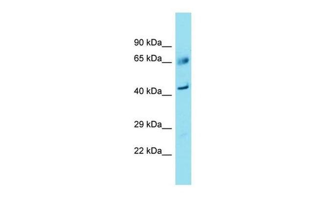 FAM83A Antibody in Western Blot (WB)