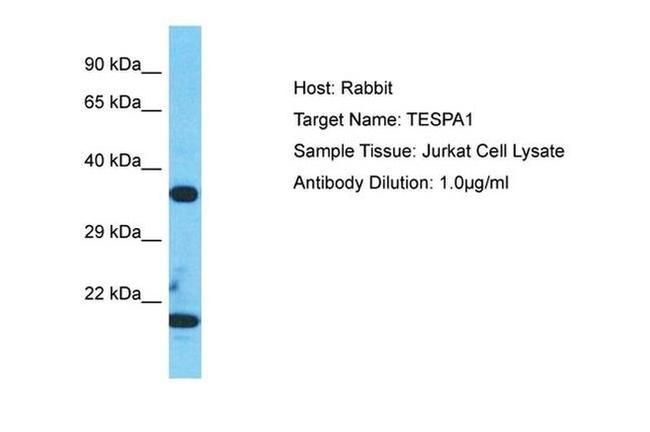 TESPA1 Antibody in Western Blot (WB)