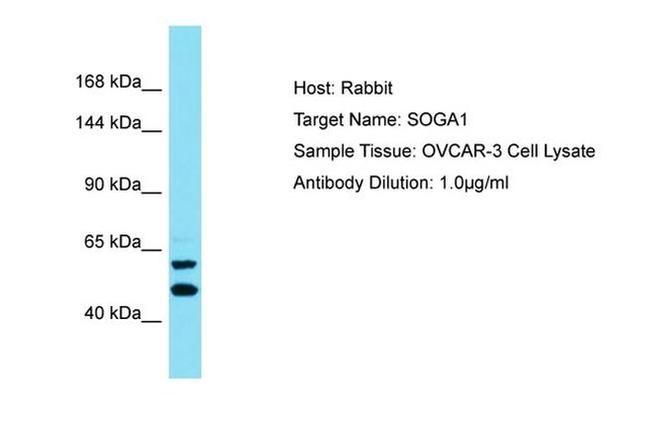 SOGA1 Antibody in Western Blot (WB)