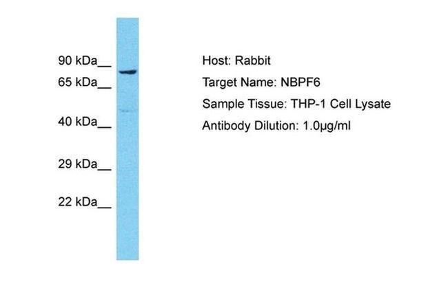 NBPF6 Antibody in Western Blot (WB)