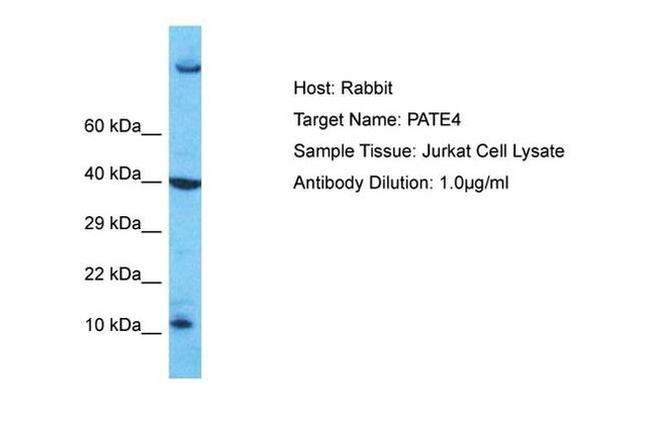 PATE4 Antibody in Western Blot (WB)
