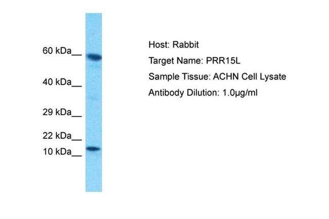 PRR15L Antibody in Western Blot (WB)