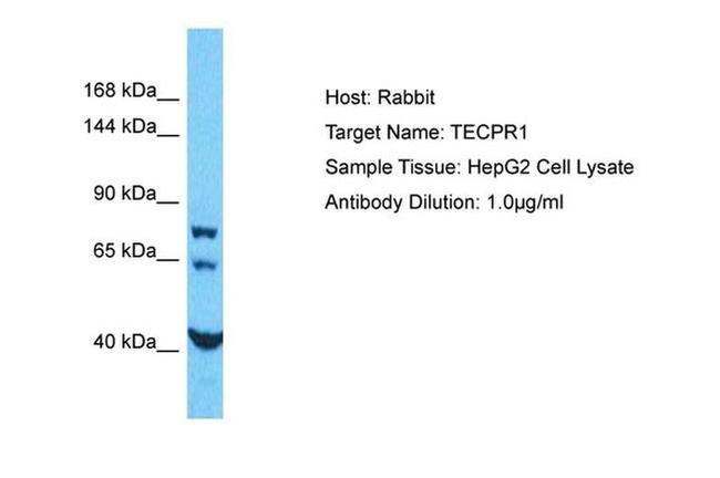 TECPR1 Antibody in Western Blot (WB)