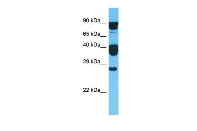 GLIPR1L2 Antibody in Western Blot (WB)