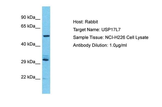 USP17L7 Antibody in Western Blot (WB)