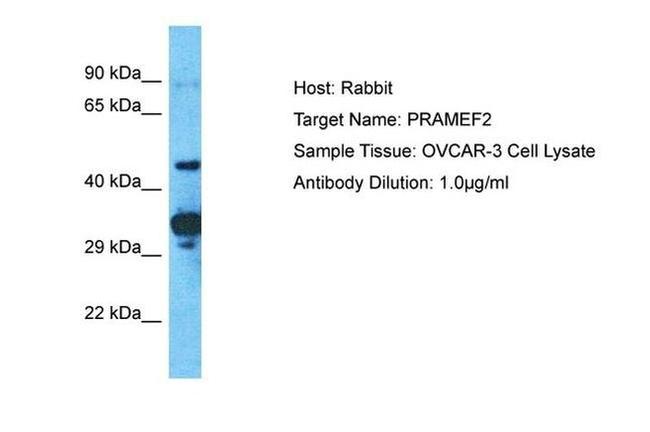 PRAMEF2 Antibody in Western Blot (WB)
