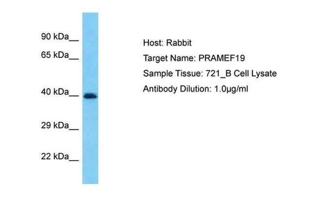 PRAMEF19 Antibody in Western Blot (WB)