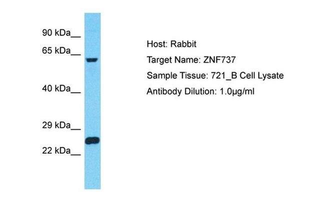 ZNF737 Antibody in Western Blot (WB)
