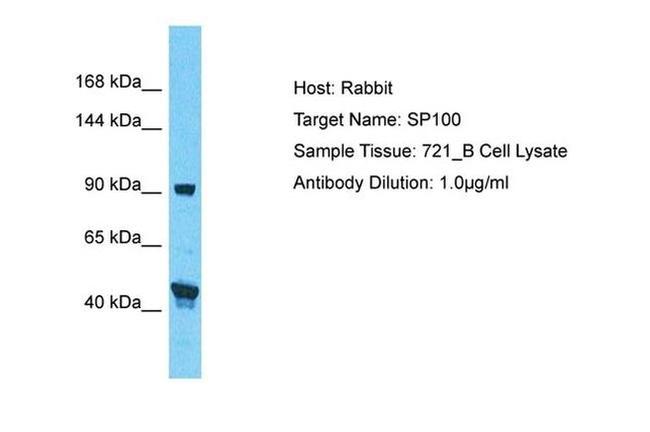 SP100 Antibody in Western Blot (WB)