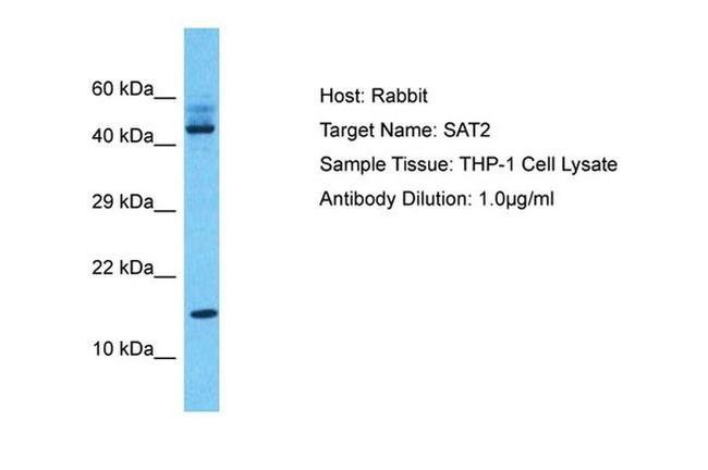 SAT2 Antibody in Western Blot (WB)