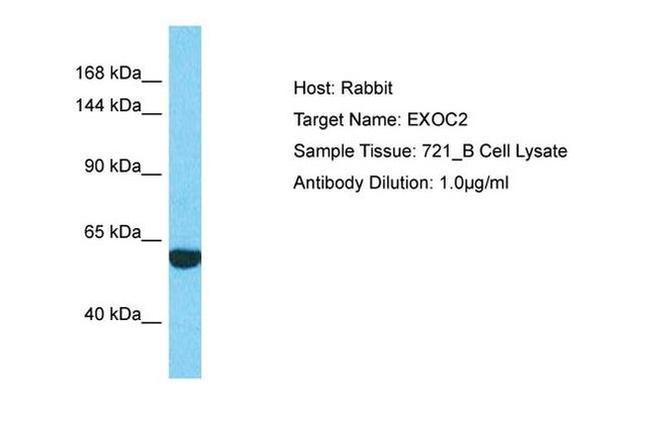 EXOC2 Antibody in Western Blot (WB)