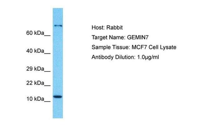 Gemin 7 Antibody in Western Blot (WB)