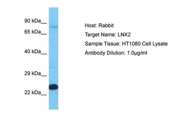 LNX2 Antibody in Western Blot (WB)
