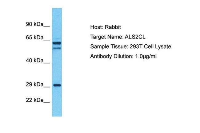 ALS2CL Antibody in Western Blot (WB)