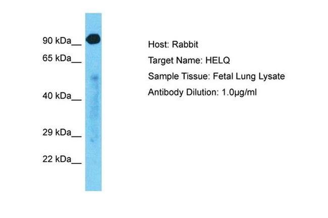 HELQ Antibody in Western Blot (WB)