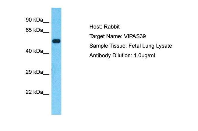 VIPAS39 Antibody in Western Blot (WB)