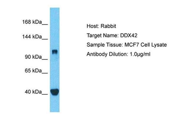 DDX42 Antibody in Western Blot (WB)