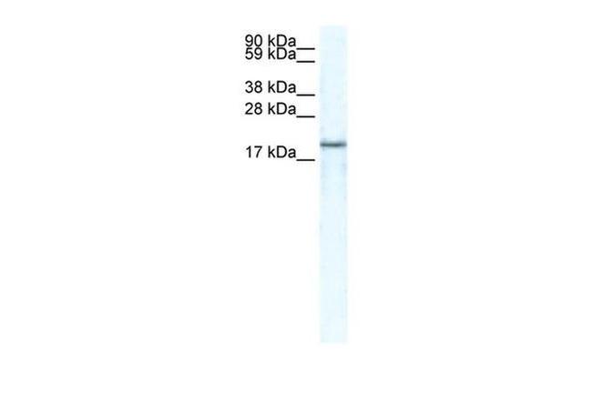 CXCL14 Antibody in Western Blot (WB)