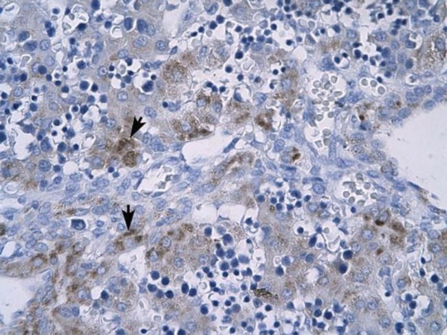 RGS9 Antibody in Immunohistochemistry (IHC)