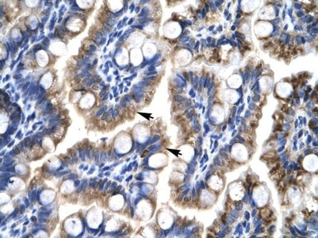 ATF5 Antibody in Immunohistochemistry (IHC)