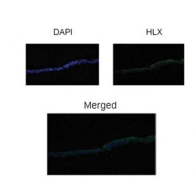HLX Antibody in Immunohistochemistry (IHC)