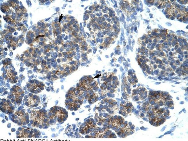 SNAPC1 Antibody in Immunohistochemistry (IHC)
