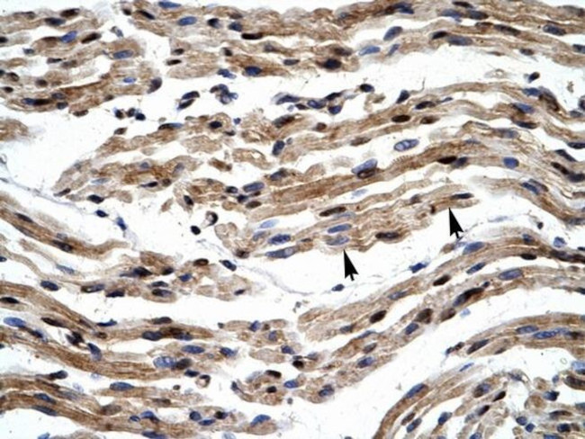 GTF2E1 Antibody in Immunohistochemistry (IHC)