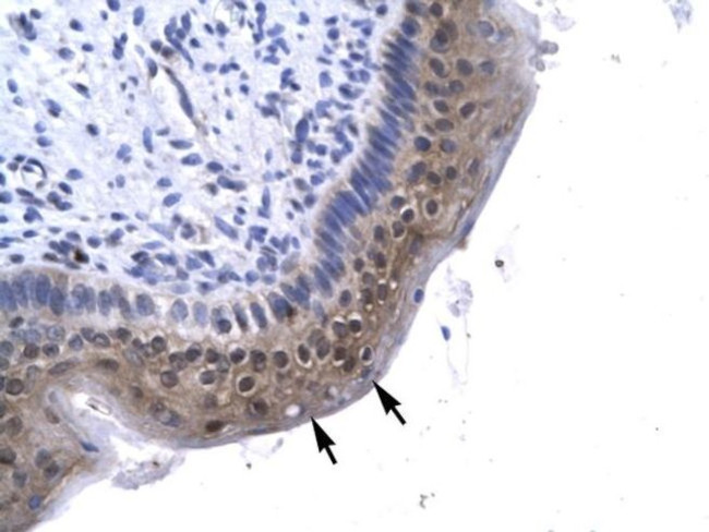 GTF2A1 Antibody in Immunohistochemistry (IHC)