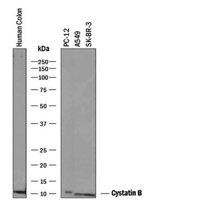 Cystatin B Antibody in Western Blot (WB)
