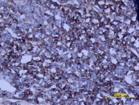 Growth Hormone Antibody in Immunohistochemistry (Frozen) (IHC (F))