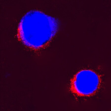 IL-2 Antibody in Immunocytochemistry (ICC/IF)