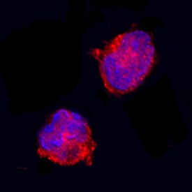 IL1RA Antibody in Immunocytochemistry (ICC/IF)