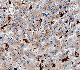 GPNMB Antibody in Immunohistochemistry (Paraffin) (IHC (P))