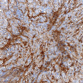 Tenascin X Antibody in Immunohistochemistry (Paraffin) (IHC (P))
