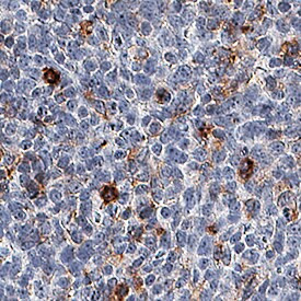 TIM3 Antibody in Immunohistochemistry (Paraffin) (IHC (P))
