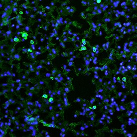 CD206 Antibody in Immunohistochemistry (Frozen) (IHC (F))