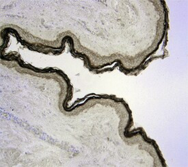 Kallikrein 7 Antibody in Immunohistochemistry (Paraffin) (IHC (P))