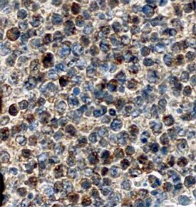 SERPINA9 Antibody in Immunohistochemistry (Paraffin) (IHC (P))