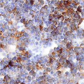 IGFBP-1 Antibody in Immunohistochemistry (Frozen) (IHC (F))