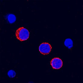 FCGR2B Antibody in Immunocytochemistry (ICC/IF)