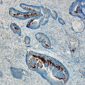 REG4 Antibody in Immunohistochemistry (Paraffin) (IHC (P))