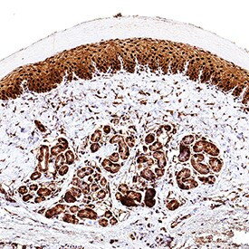 FABP5 Antibody in Immunohistochemistry (Paraffin) (IHC (P))