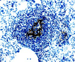 WISP1 Antibody in Immunohistochemistry (Frozen) (IHC (F))
