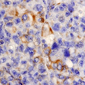 MIA Antibody in Immunohistochemistry (Paraffin) (IHC (P))