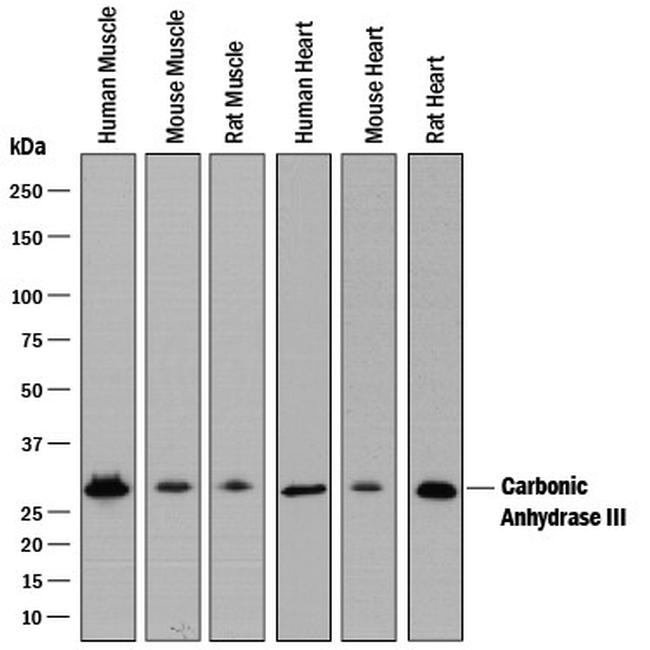 Carbonic Anhydrase III Antibody in Western Blot (WB)