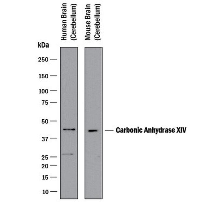 Carbonic Anhydrase XIV Antibody in Western Blot (WB)