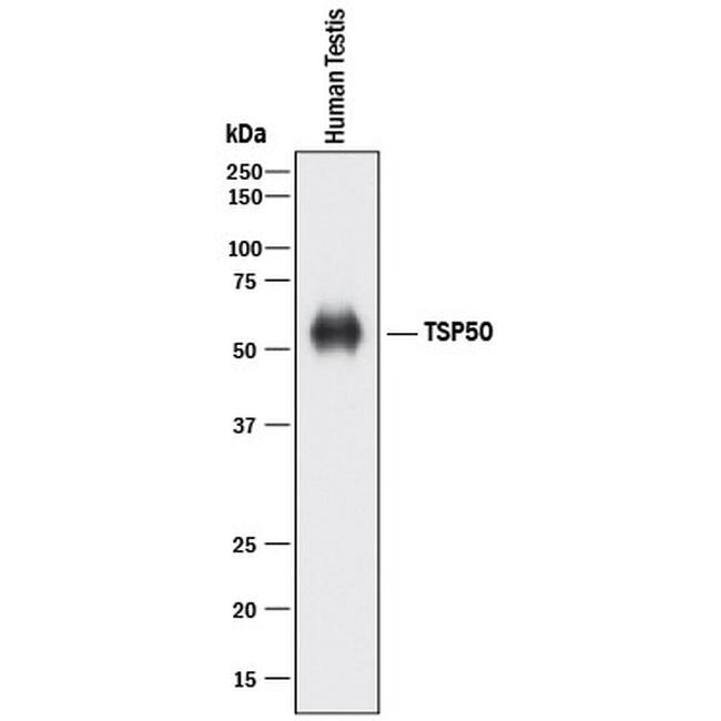 TSP50 Antibody in Western Blot (WB)