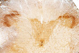 RGMA Antibody in Immunohistochemistry (Paraffin) (IHC (P))