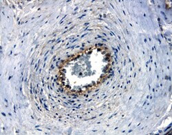 Nectin 4 Antibody in Immunohistochemistry (Paraffin) (IHC (P))