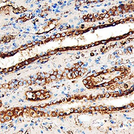 LUM Antibody in Immunohistochemistry (Paraffin) (IHC (P))